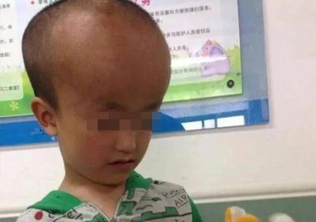 郴州大头娃娃事件